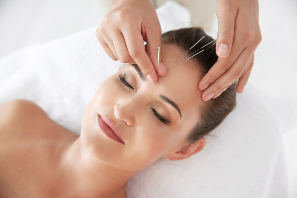 facial acupuncture near me