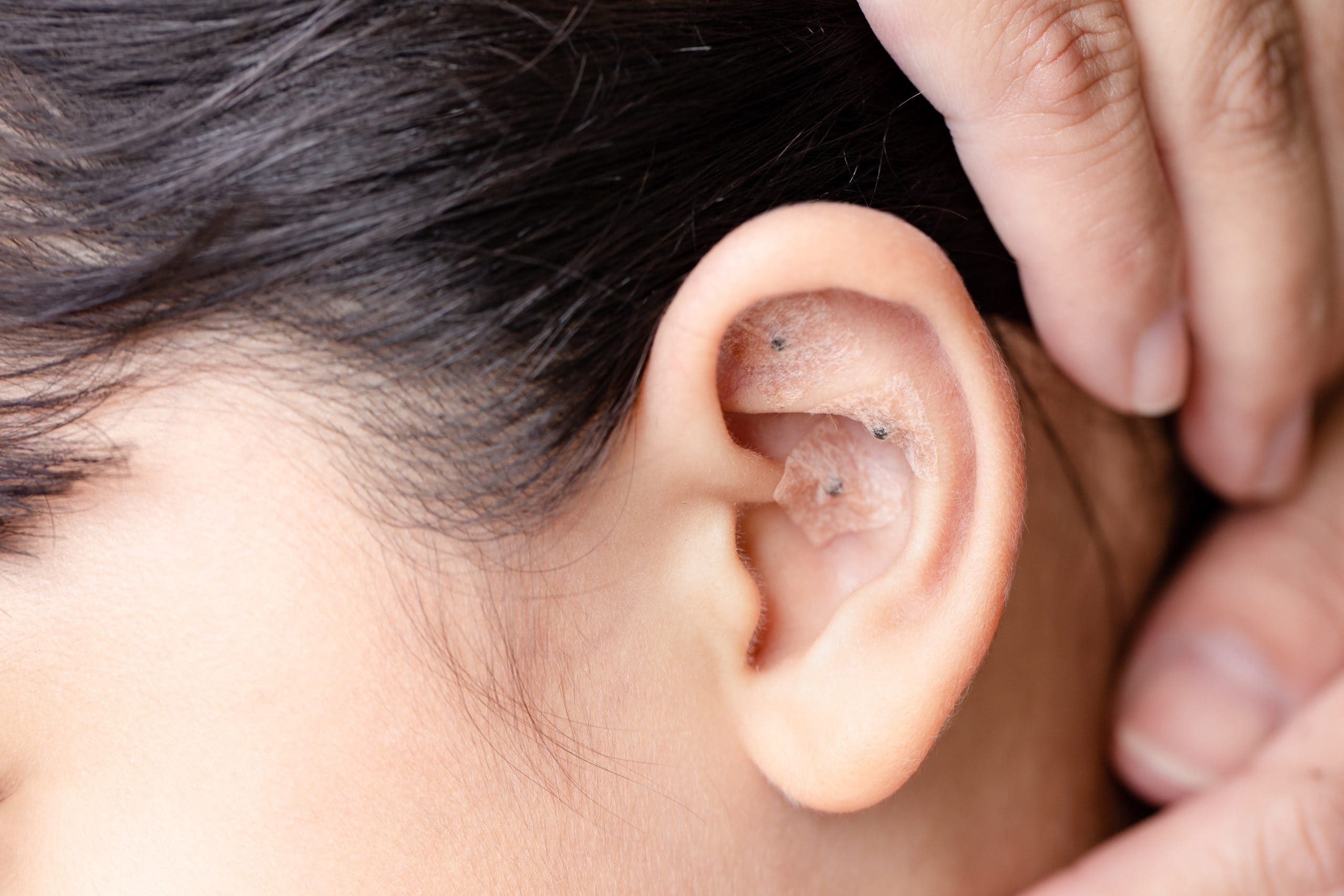 acupuncture doctors near me
