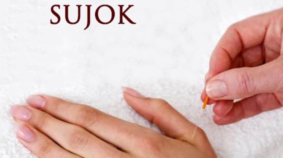Chinese acupuncture near me